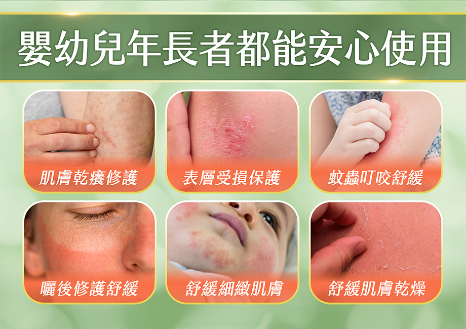 山芙蓉草本修護凝膠_嬰幼兒年長者都能安心使用